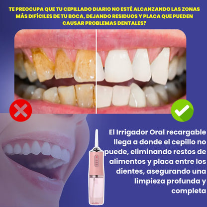 Irrigador Oral recargable ➕Pasta de dientes blanqueadora😁